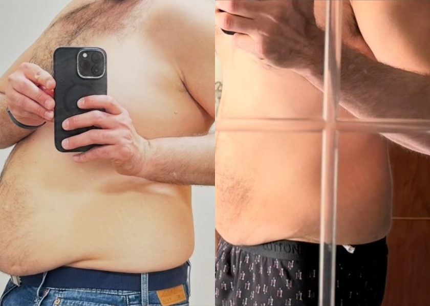 Client before and after, dramatic loss around the waist
