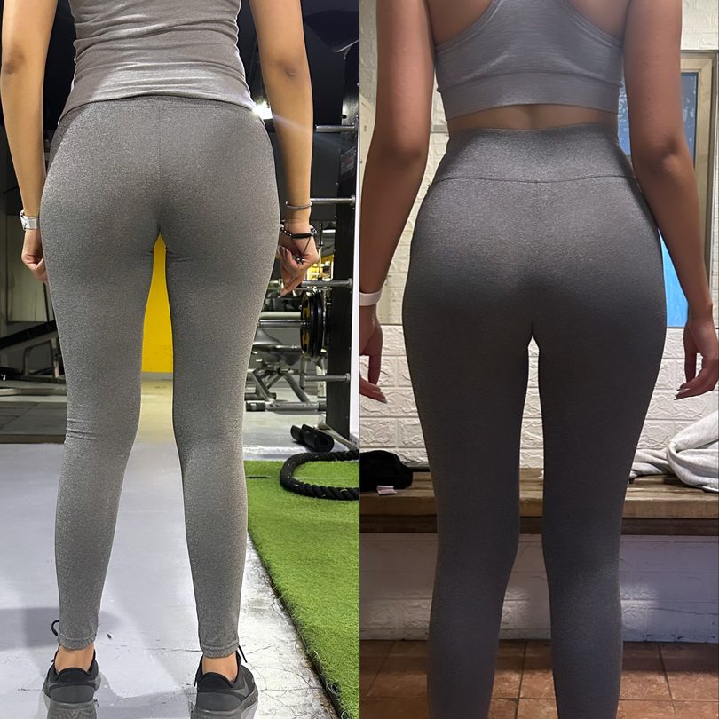 Client before and after, a stronger, more confident shape